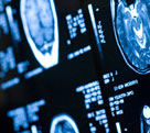 NEUROLOG